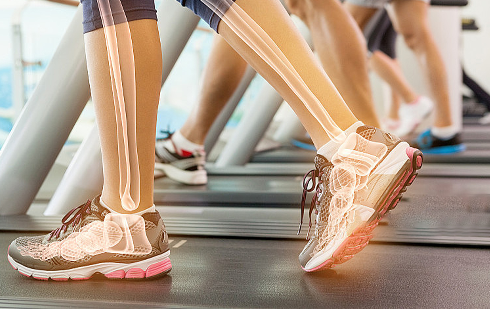 Shockwave Therapy Machine